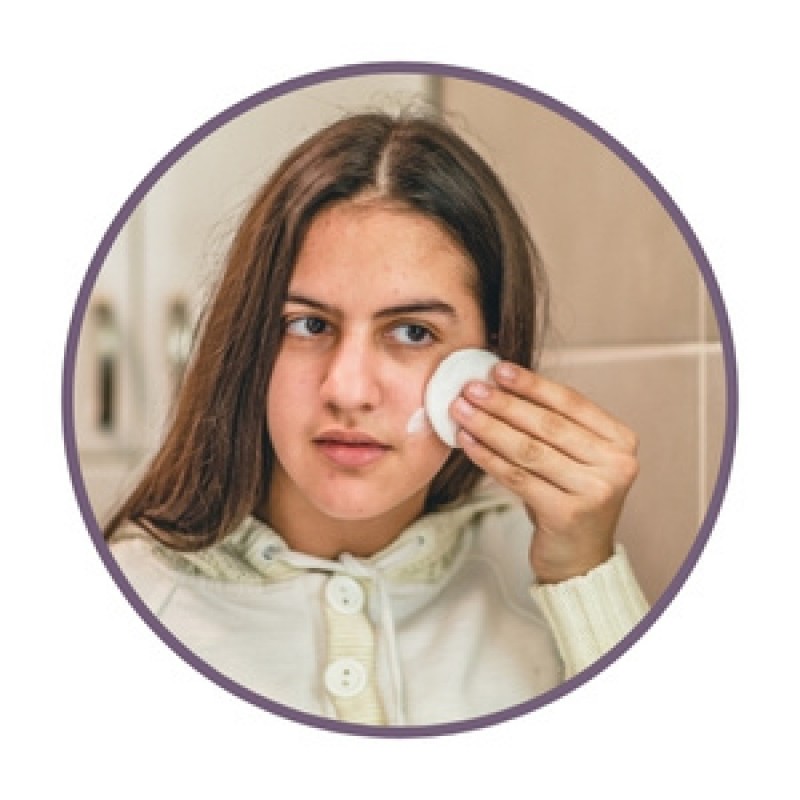 Natural acne creams