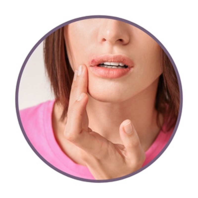 Ointments for cold sores
