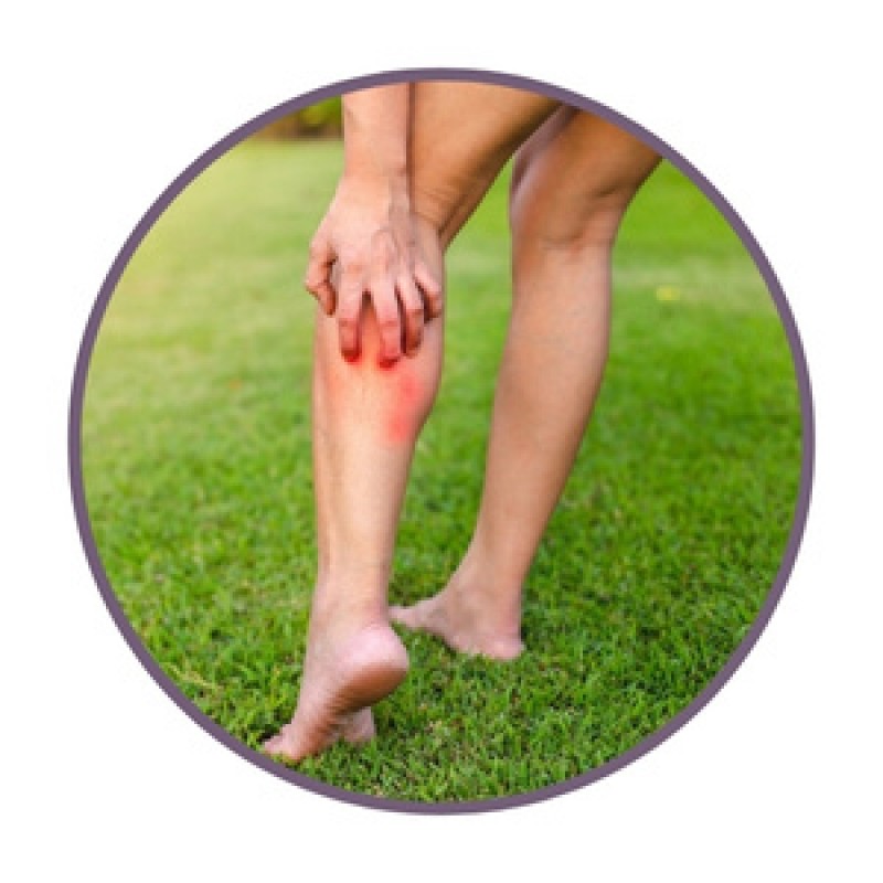 Ointments for skin irritations