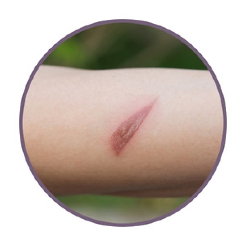Ointments for wounds