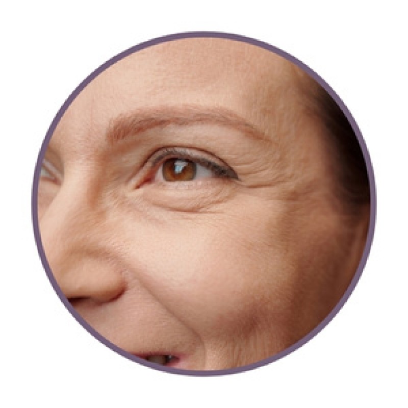 Wrinkle creams