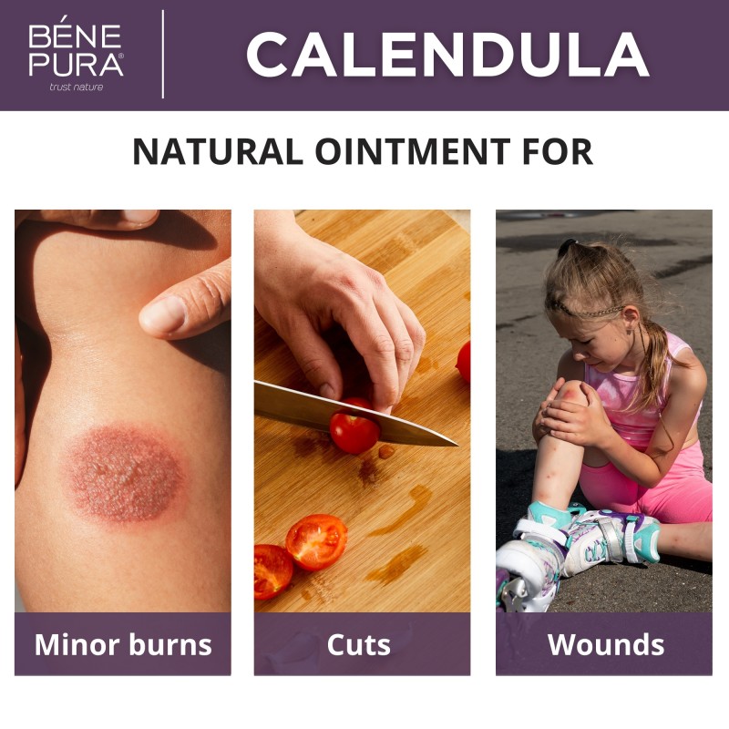 Ointment for Wounds, Burns and Scars with Calendula - 40ml