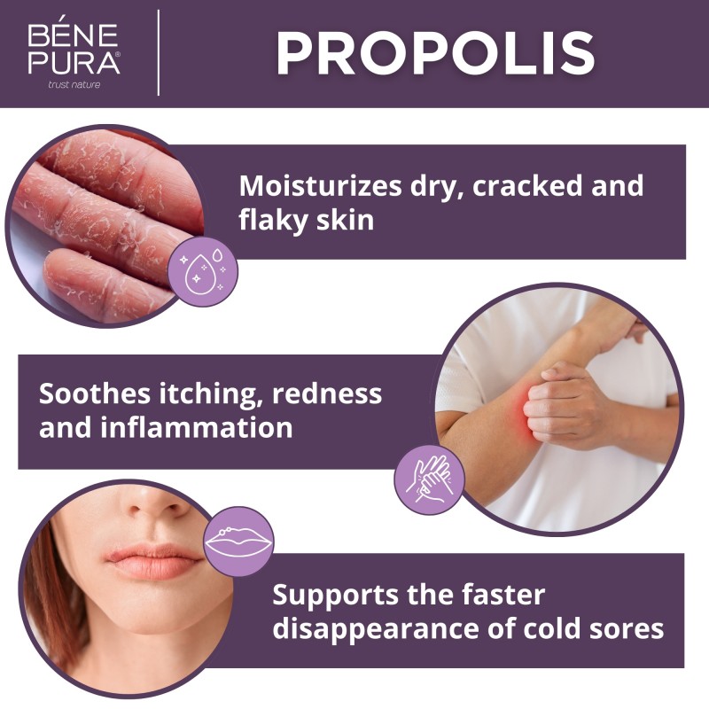 Propolis ointment for Dry skin with 30% Propolis - 40ml