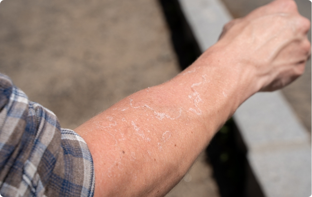 As an oil for irritated and dry skin