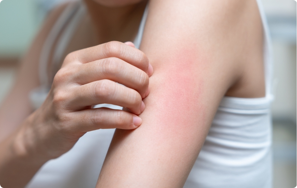 As a antiseptic and antibacterial agent for minor skin injuries